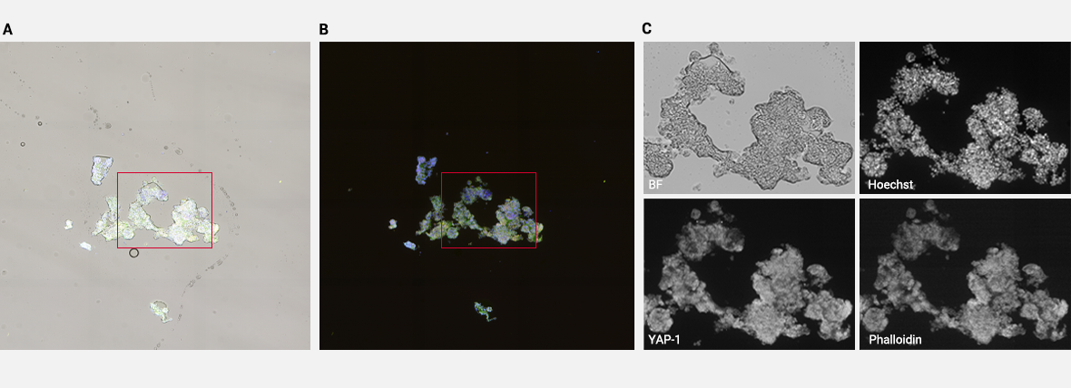 Seamless Image Stitching Using The CELENA X High Content Imaging