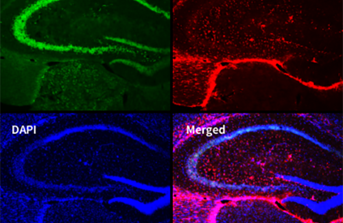 LogosBiosystems-CELENA-S-Digital-Imaging-System-Mouse-brain-image-01