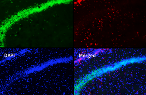 LogosBiosystems-CELENA-S-Digital-Imaging-System-Mouse-brain-image-02