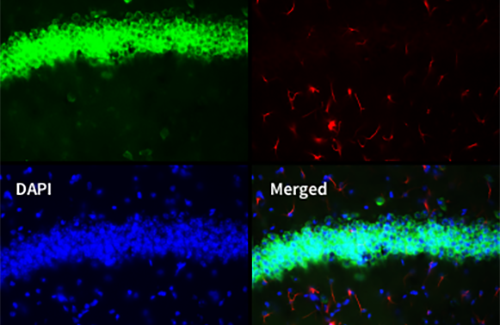 LogosBiosystems-CELENA-S-Digital-Imaging-System-Mouse-brain-image-03