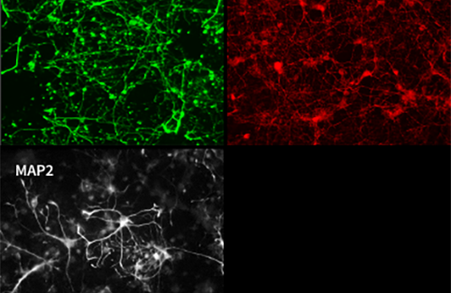 LogosBiosystems-CELENA-S-Digital-Imaging-System-Mouse-neuron-primary-cultures-image